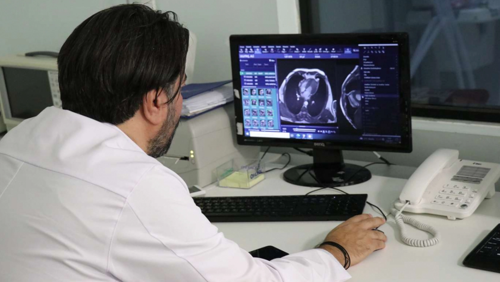 Turgut Özal Tıp Merkezinde 'Kardiyak MR' hizmeti verilmeye başlandı